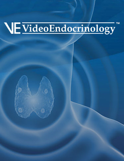 Radiofrequency Ablation Is a Thyroid-Sparing Technique for Treatment of Intrathyroidal Parathyroid Adenoma